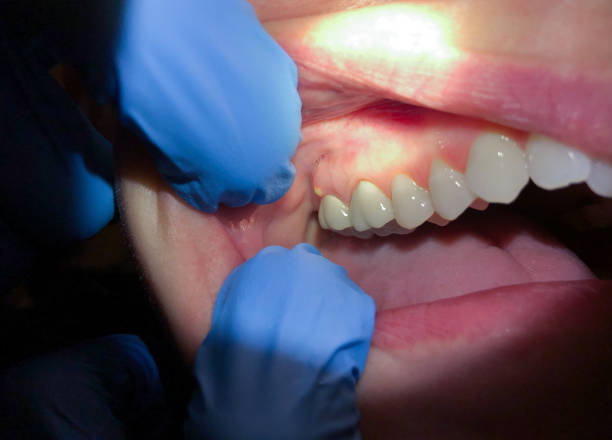 Best Walk-In Emergency Dentist in Auxvasse, MO