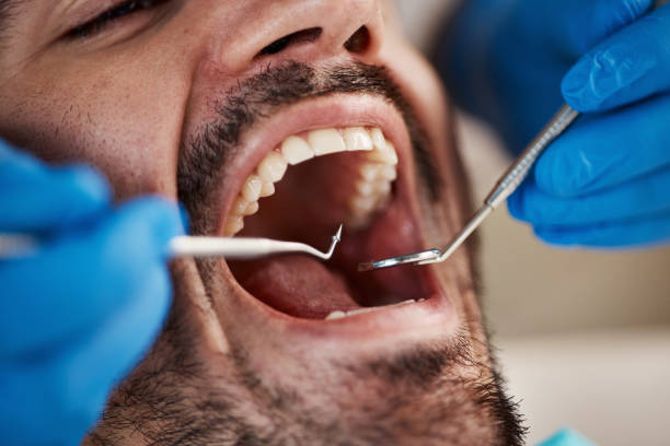Best Pediatric Emergency Dentist in Auxvasse, MO